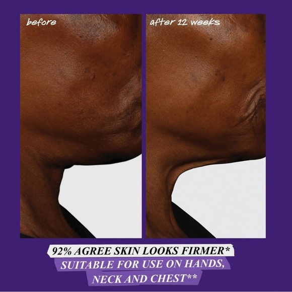 ONLY 1! Kiehl’s Micro-Dose Anti-Aging Retinol Serum Mini💧 NEW - Picture 5 of 11